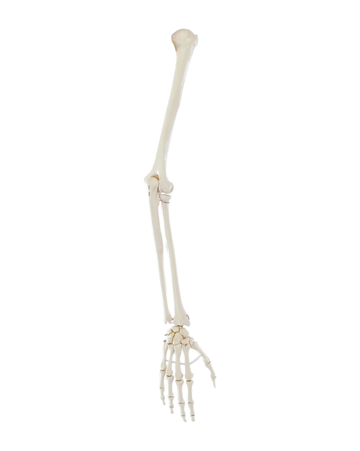 Armskeltt
