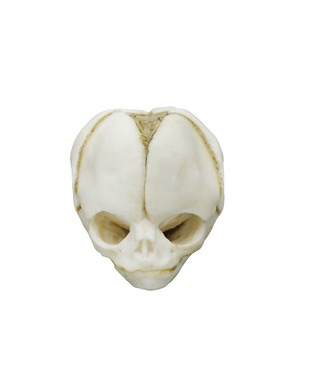 Replica fetal skull, 20 weeks