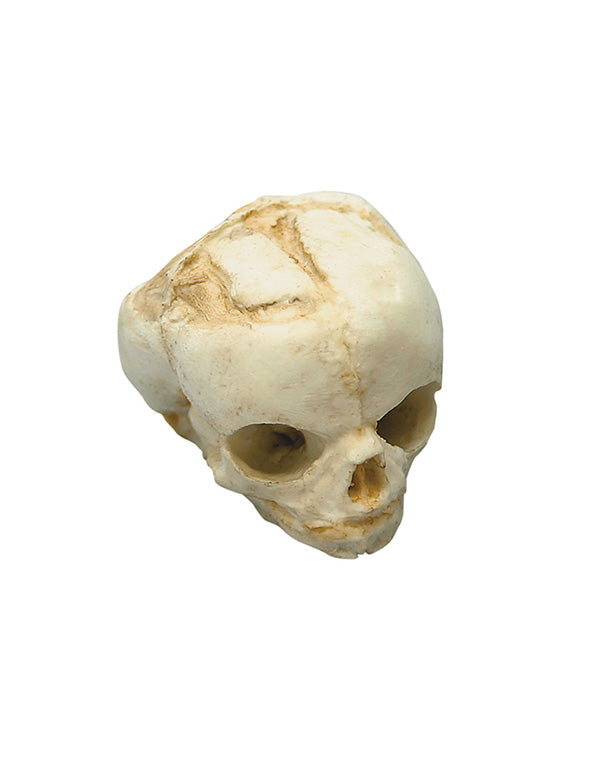 Replica fetal skull, 17 weeks