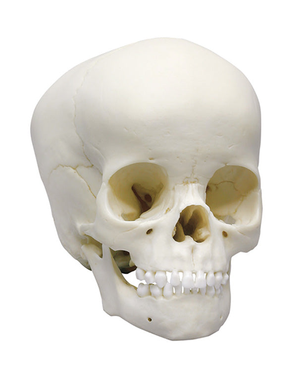 Replica child skull, 4-year-old