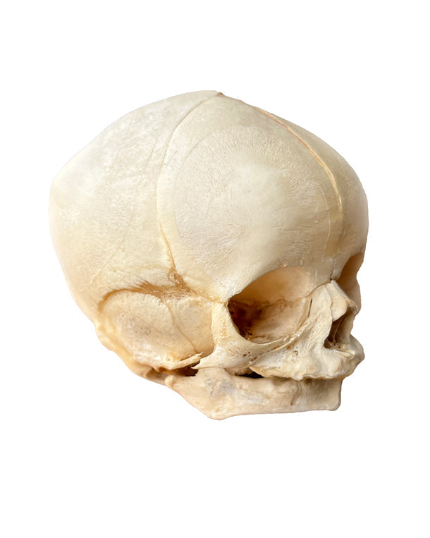 Real fetal skull 