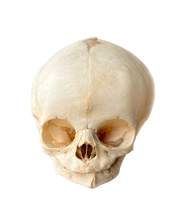 Real fetal skull 