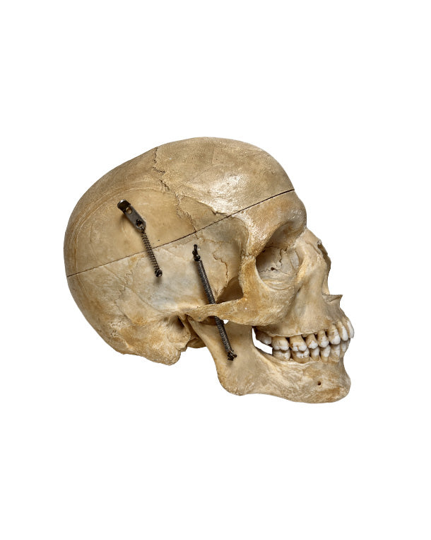 Echter menschlicher Schädel kaufen bei SwissSkulls – detailgetreue, restaurierte Schädel für Anatomie, Medizin und Sammlung.