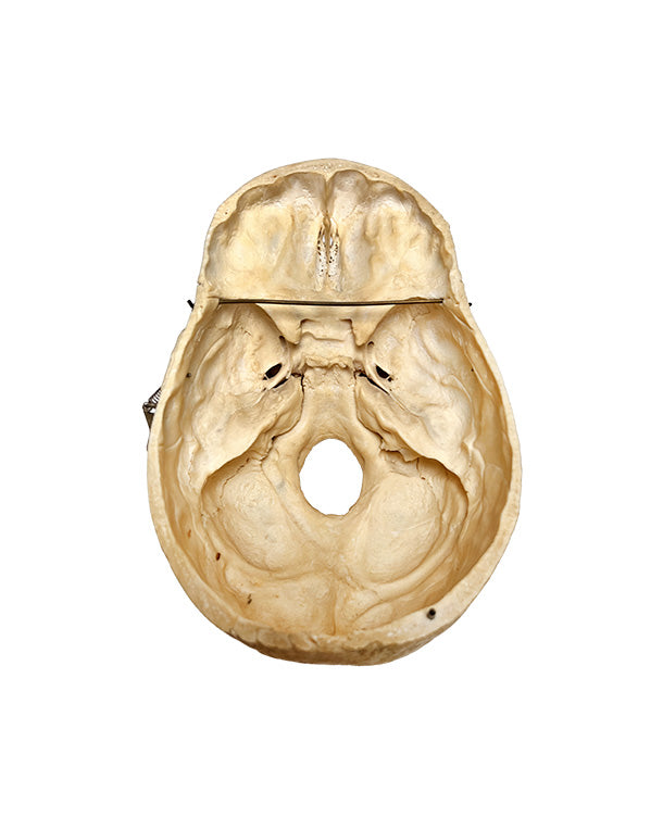 Echter menschlicher Schädel kaufen bei SwissSkulls – detailgetreue, restaurierte Schädel für Anatomie, Medizin und Sammlung.