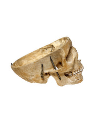 Echter menschlicher Schädel kaufen bei SwissSkulls – detailgetreue, restaurierte Schädel für Anatomie, Medizin und Sammlung.