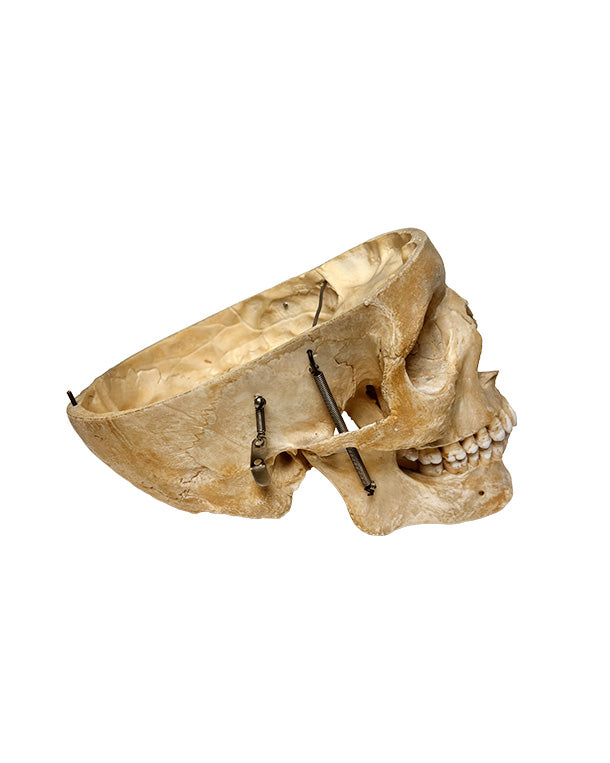 Echter menschlicher Schädel kaufen bei SwissSkulls – detailgetreue, restaurierte Schädel für Anatomie, Medizin und Sammlung.