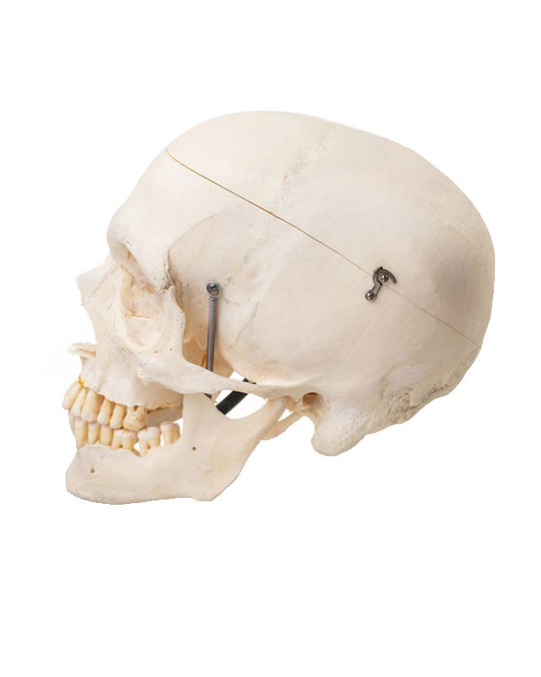 Real human skull (removable skull plate)