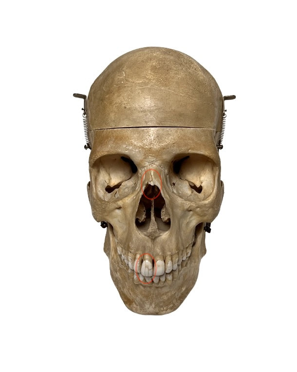 Echter menschlicher Schädel kaufen bei SwissSkulls – detailgetreue, restaurierte Schädel für Anatomie, Medizin und Sammlung.