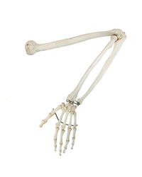 Echter menschlicher Arm – restauriertes anatomisches Knochenpräparat mit Ober- und Unterarmknochen