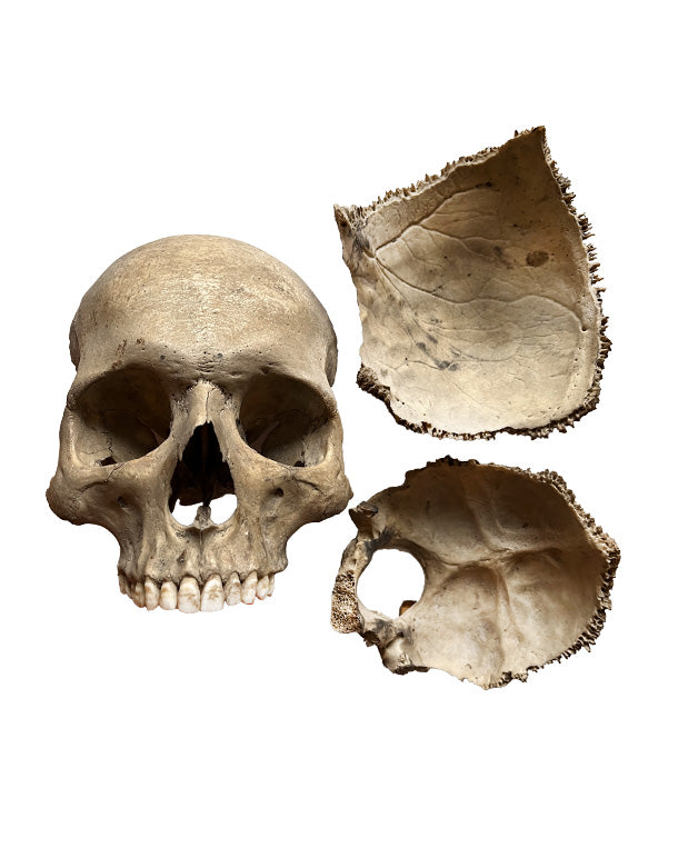 Real Human Skull (3 Parts)