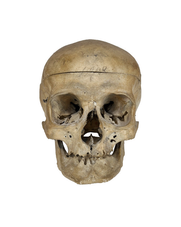 Real Human Pirate Skull