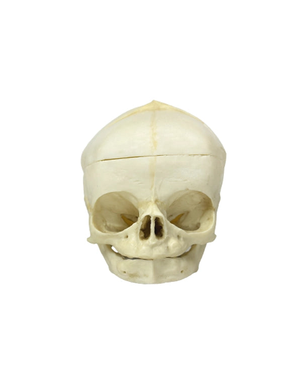 Lehrmodell Fetusschädel 40 Wochen mit Fontanellen und Schädelbasisöffnungen